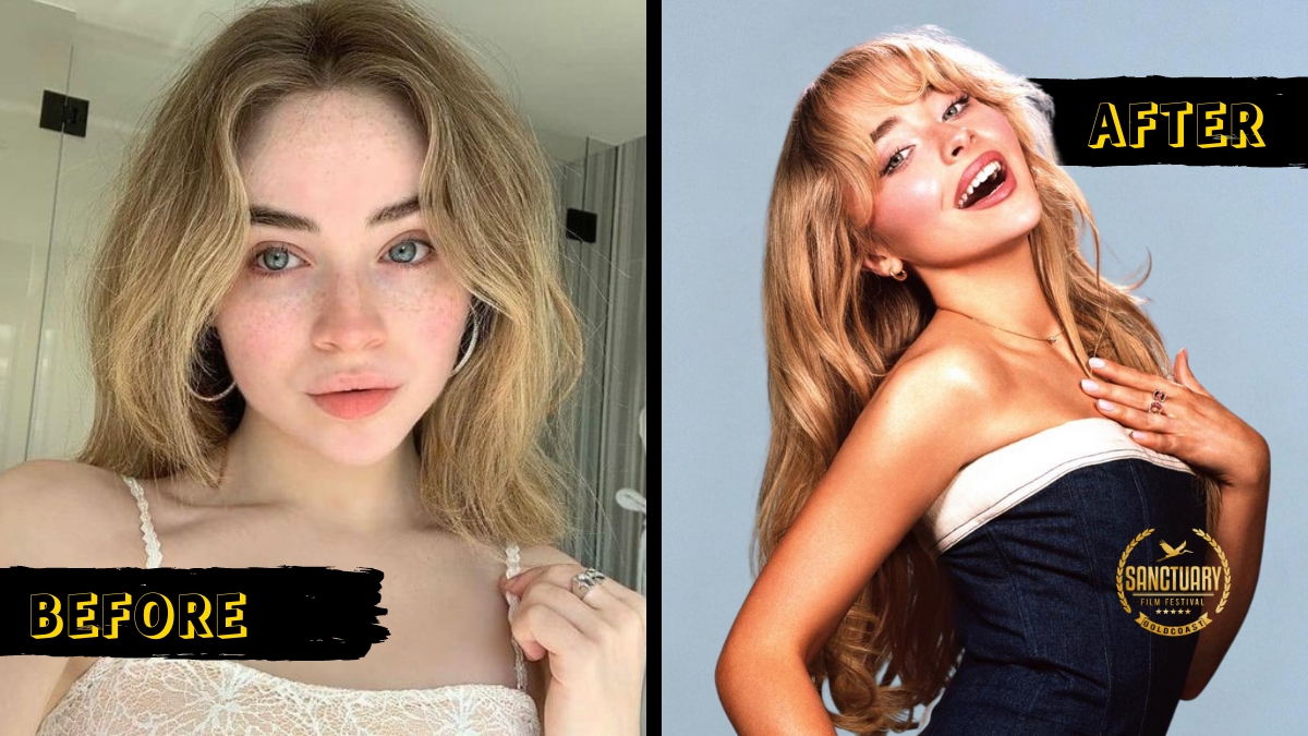 Sabrina Carpenter Plastic Surgery Rumors Remain Purely Speculative